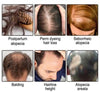 Image of MINIOTIC F - Finasteride 0.1% & Minoxidil 5% Topical Solution VitalLocks & Wellness